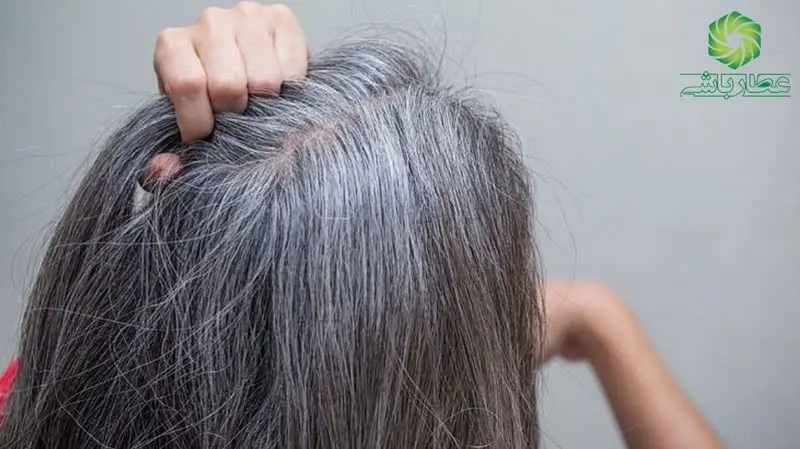 روش های جلوگیری از سفید شدن مو و راه های درمان-عطارباشی