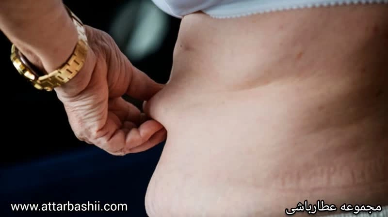 لاغری شکم و ران در 5 روز + بدون رژیم-مجموعه عطارباشی